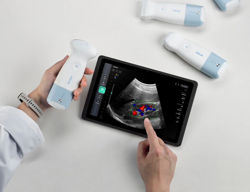 Asus Handheld Ultrasound L U800 Scenario